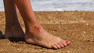 Four Floridians Die from Flesh-Eating Bacteria This Year