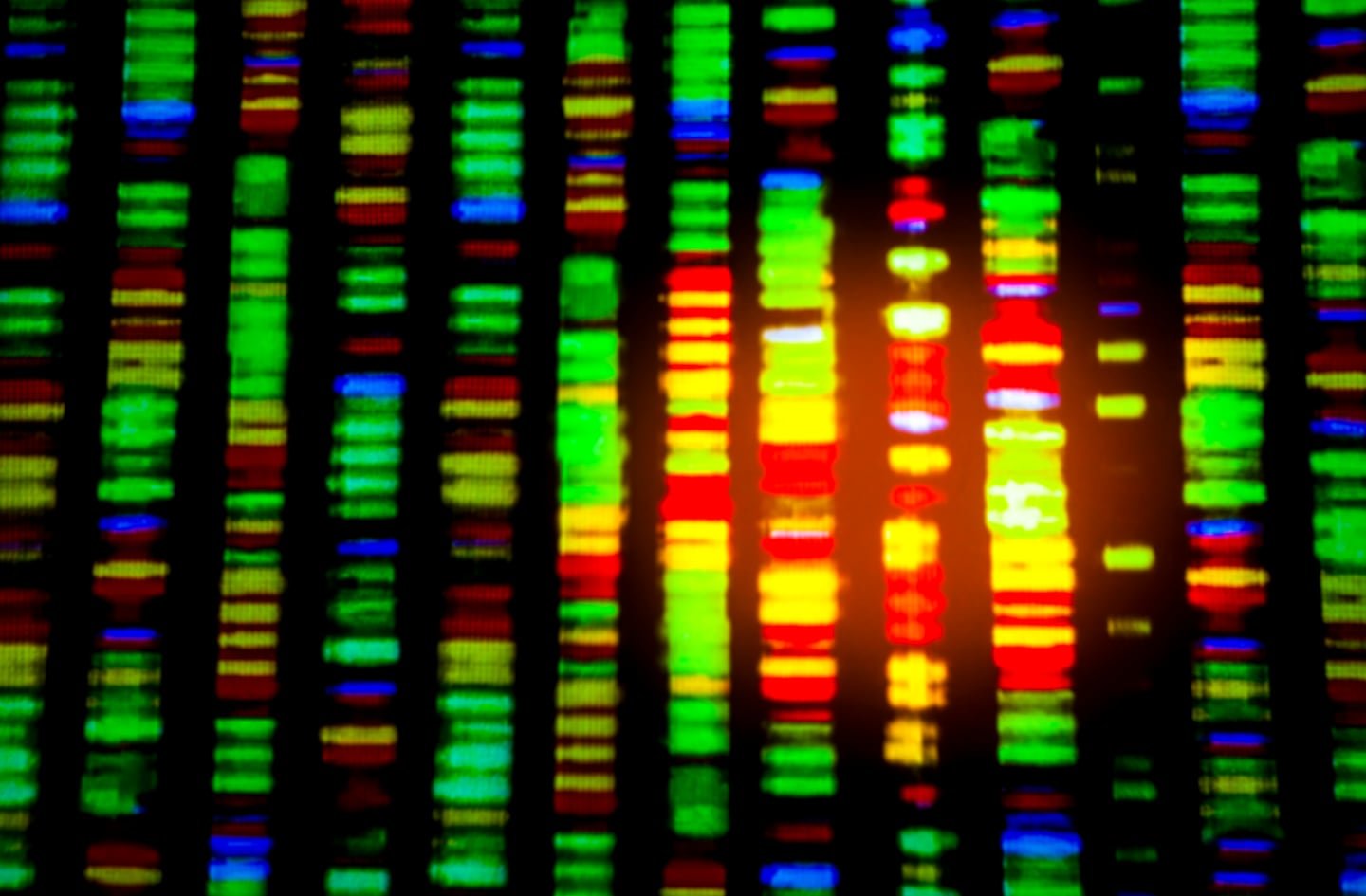 Washington Tests New Strategies to Tackle Soaring Prices of Million-Dollar Medical Cures