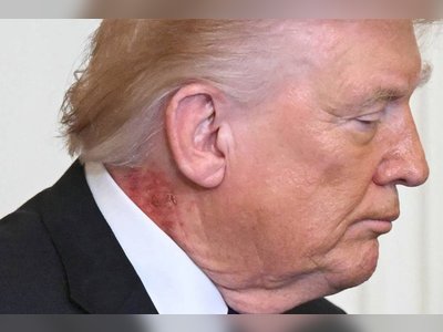 White House Explains Noticeable Redness on President Trump’s Neck